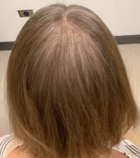 Thinning hair before using shower filter